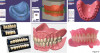 Fig 18. Fabrication of a denture. CBCT scans of the arches are taken instead of a physical impression. This process can be completed entirely in the dental office, or the scans and bite registration can be sent to a commercial laboratory for fabrication.