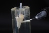 Fig 10. A translucent shaded flowable resin composite was injected into the matrix, and the fiber post was then inserted into the material until it reached the base of the post space. The resin composite was cured through the clear matrix from all sides for 40 seconds each.