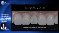 Shade Matching Fundamentals: Achieving Esthetic Results with Direct Composites Webinar Thumbnail