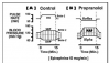 Figure 2. Epinephrine beta-blocker interaction. In this illustration the following cardiovascular changes follow the administration of epinephrine in a dosage of 10 mg/min. (A) First, it is essential to understand the precise cardiovascular influences of epinephrine in a normal (control) patient. The cardiotonic effects of epinephrine are most familiar. It activates beta-1 receptors on the sinoatrial node to increase heart rate (HR) and also activates beta-1 receptors on myocardial cells increasing their force of contraction. This provides an increase in systolic blood pressure (SBP). In addition to its cardiotonic effects, epinephrine has the ability to activate both alpha and beta-2 receptors on blood vessels producing constriction or dilation, respectively. Epinephrine is commonly viewed only as a vasoconstrictor by many clinicians because this is the effect it produces when injected subcutaneously or submucosally. This is because the tiny vessels found in these locations contain only alpha-receptors and are constricted by epinephrine. In contrast, larger systemic arteries that determine vascular resistance and diastolic blood pressure contain both alpha and beta-2 receptors, with the latter most prevalent. Following absorption, low doses of epinephrine found in local anesthetic formulations (eg, 20 mg to 100 mg) preferentially activate beta-2 receptors, which dilate the arteries, and diastolic blood pressure (DBP) actually declines. (B) In the presence of a nonselective beta-blocker (eg, propranolol) the cardiovascular influences of epinephrine are strikingly different. This is primarily due to the blockade of beta-2 receptors on systemic arteries. Epinephrine will now activate the remaining alpha-receptors leading to vasoconstriction and an increase in diastolic blood pressure. To meet this increase in resistance, intrinsic mechanisms within myocardial cells respond with greater force and elevate systolic blood pressure as well. Together this will increase mean arterial pressure (MAP). The sudden elevation in MAP is sensed by baroreceptors within the carotid sinuses triggering a reflex slowing in heart rate, which is further accentuated by the fact that the beta-1 receptors in the sinoatrial node are blocked.