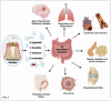 (1.) Examples of conditions that can occur when dysbiotic bacteria associated with periodontitis disrupt the GI microbiome via salivary transfer and lead to systemic disruptions through generalized inflammation.