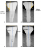 (7.) Yi Transmucosal profiles.