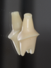 (34.) Single anterior custom abutment workflow.