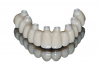 (27.) Metal-free, final zirconia structure direct to multi-unit abutments.