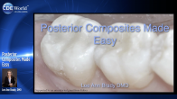 Posterior Composites Made Easy Webinar Thumbnail