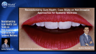 Revolutionizing Gum Health: Case Study on Non-Invasive Approaches for Systemic Wellness Webinar Thumbnail