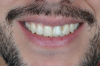 Fig 2. Preoperative close-up view of patient’s smile.