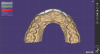 Fig 11. Occlusal view of computer-aided design and manufacture of final porcelain veneers.