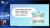 Enhanced Case Selection for Clear Aligners: When and Why CBCT Makes a Difference Webinar Thumbnail