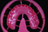 Figure 11: Milled denture base from a PMMA puck.