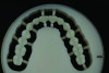 Figure 12: Milled denture teeth from PMMA. puck.