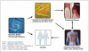 Fig 1. Potential mechanisms linking periodontal disease and infertility.