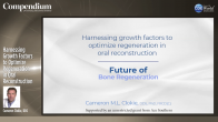 Harnessing Growth Factors to Optimize Regeneration in Oral Reconstruction Webinar Thumbnail