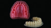 Fig 1. Complete denture fabrication process with 3D printing.