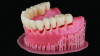 Fig 2. The bonding of 3D-printed teeth to a CD base.