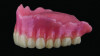 Fig 3. 3D-printed denture finishing and polishing.