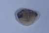 (35.) Inner surface of the fractured cusp after sandblasting and enamel etching, showing amalgam staining and small cracks, now prepared for adhesive reattachment.