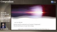 Advancing Periodontal and Implant Treatment: The Clinical Power of Laser Technology Webinar Thumbnail