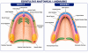 Figure 1: Important anatomical landmarks for maxilla and mandibula.