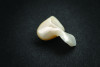 Fig 11. Zirconia RBFDP minimum framework dimensions: connector width of 2 mm, connector height of 3 mm, and retainer wing thickness of 0.7 mm.