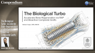The Biological Turbo: Accelerate Bone Regeneration via RAP and Bioactive Composite Grafts Webinar Thumbnail