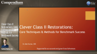 Clever Class II Restorations: Core Techniques & Methods for Benchmark Success Webinar Thumbnail