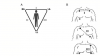 Figure 4. A) Einthoven’s triangle; and B) standard limb leads I, II, and III.