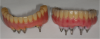 Fig. 38 through Fig. 40 A zirconium bridge was copy-milled. Zirconium was stained and glazed and 1 mm to 2 mm of porcelain was layered to the incisal and occlusal surface.