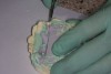 Figure 6 A scalpel was used to cut through the impression material and separate the posterior section.