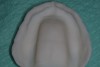 Figure 14 The intaglio surface of the prototype denture.