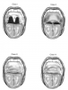 Figure 2. Mallampati airway classification. An increase in Mallampati class correlates with increased risk for difficulty in airway management. Class I: complete visualization of uvula, tonsillar pillars, and soft palate. Class II: only partial visualization of the uvula. Class III: only soft palate visible. Class IV: only hard palate visible. (Redrawn from Frerk CM. Anaesthesia. 1991;46:1005-1008.)