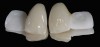 Fig. 7  All-ceramic resin-bonded bridges.