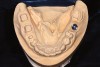 Fig 8. Master model for full-arch treatment provides excellent detail of prepared teeth and occlusal surfaces of unprepared teeth.
