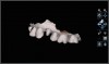 An example of lingual, buccal, and occlusal digital impression scans.