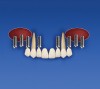 Figure 8h  The provisional prosthesis is re-placed on teeth Nos. 6 through 11, with teeth Nos. 5 and 12 cantilevered.
