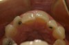 Figure 5  The preoperative occlusal view.