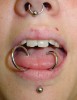 Figure 2  Tongue rings and mandibular labrette.