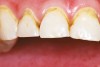 Figure 2  Close up of teeth Nos. 7 through 9.
