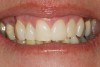 Figure 1  Pretreatment view of full smile.