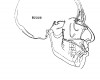 Figure 3  Maturation and aging results in both further skeletal change as well as soft-tissue growth. Vertical alveolar growth, maxillary and mandibular change, and change in soft tissue result in a clockwise rotation of the nasolabial complex.