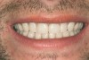 Figure 7  FINAL RESULTS Completing dental treatment gave Joe a newfound sense of self-esteem.