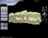 Figure 5  Scanned preparation digital model.