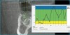 Figure  19  Hounsfield units of each millimeter of proposed osteotomy calculated via planning software.