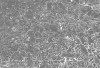 Figure 4  Scanning electron of the microstructure of a feldspathic veneer porcelain. Acid-etching removes the glass and reveals the leucite crystals.