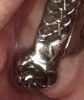Figure 14  Maxillary prosthesis framework try-in. Telescopic crown on the right molar.