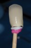 Figure 16  Cementation technique of creating a duplicate abutment using dense bite registration paste within the implant crown. Cement applied to the inner aspect of the crown.
